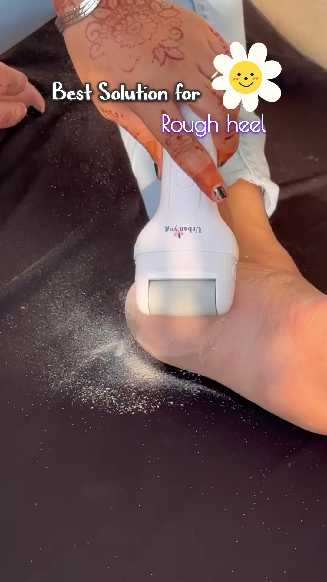 Electric Foot Callus Remover with Roller Head for Smooth Feet